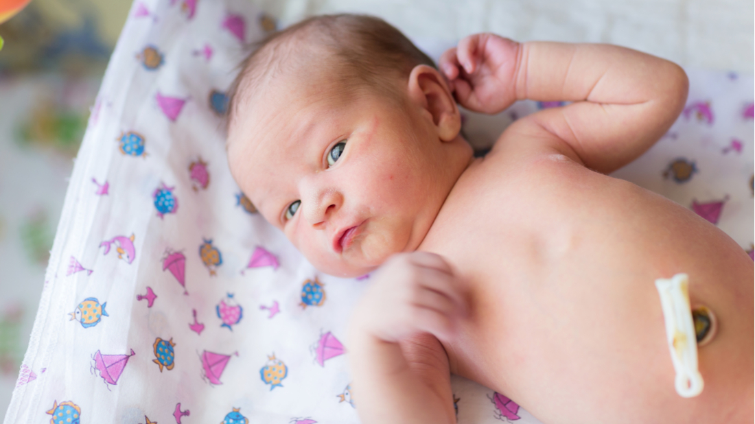 pece o pupik novorozence