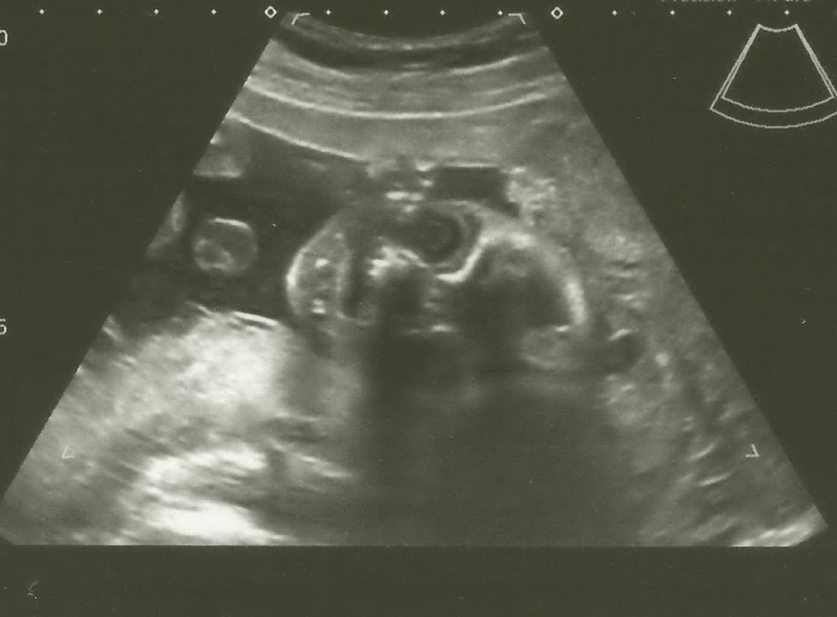 Fotografie (Krásný, šťastný, úspěšný)