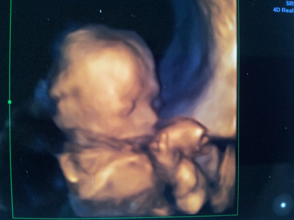 Fotografie (20. týden: Z „červíčka“ je holčička :o))