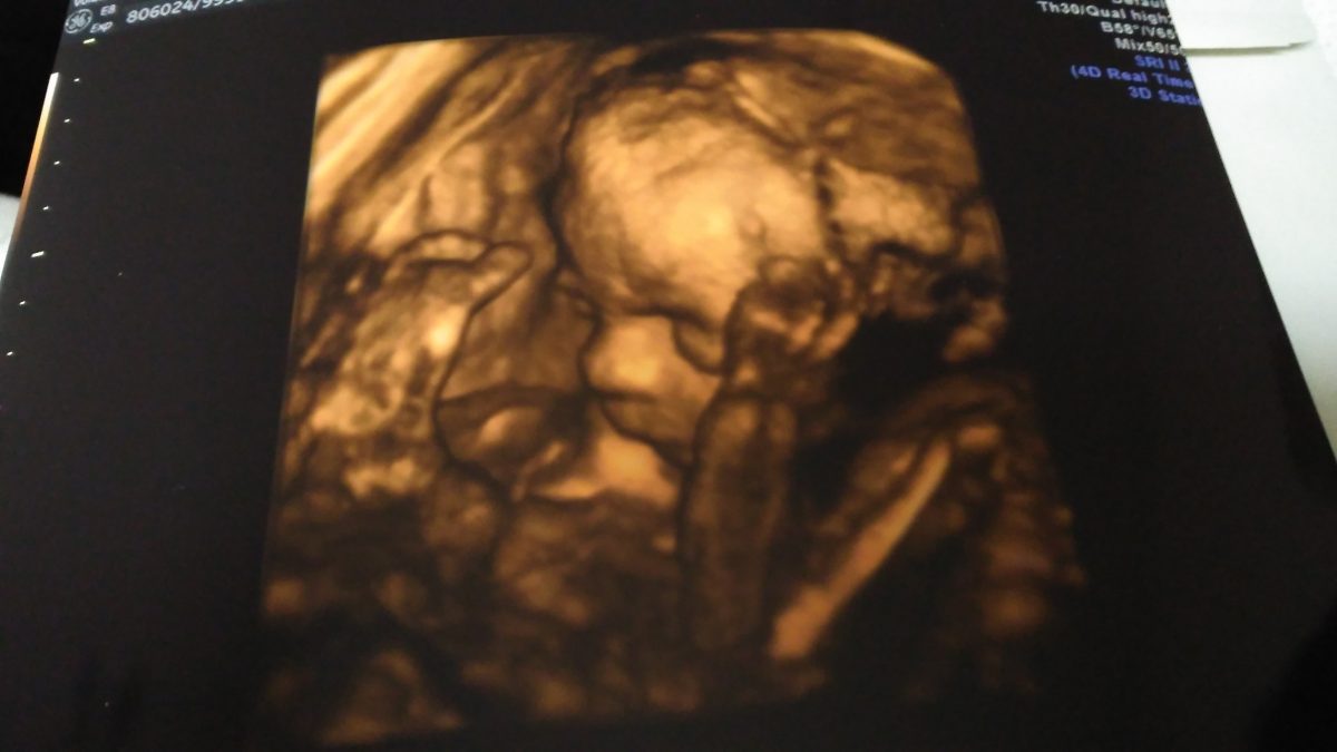 Fotografie (4D ultrazvuk? Možná příště…)