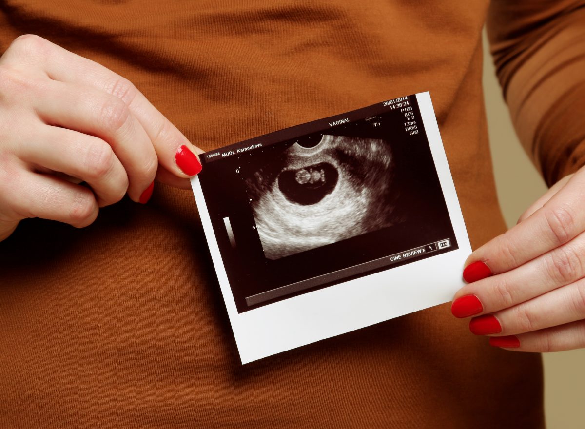 Fotografie (Cukr za námi ;-) )