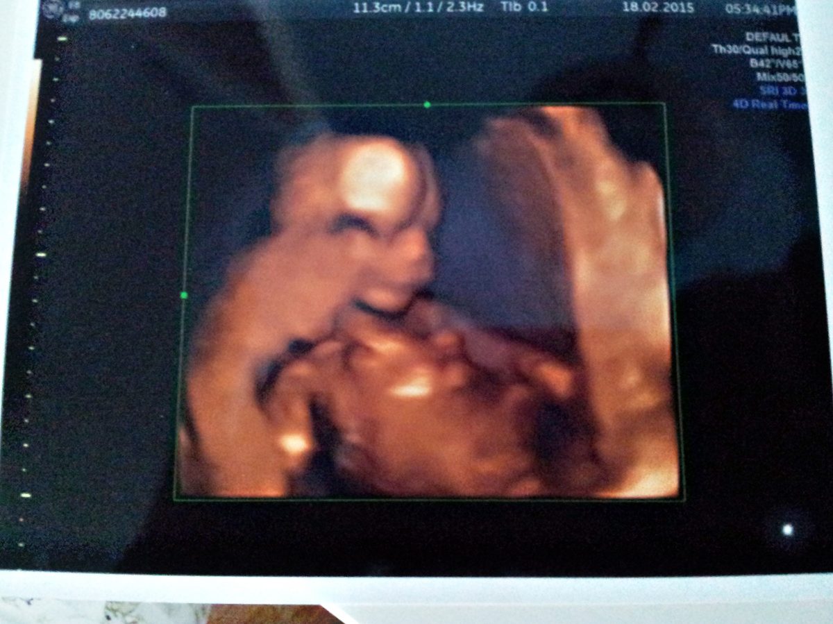 Fotografie (15. týden nového života)