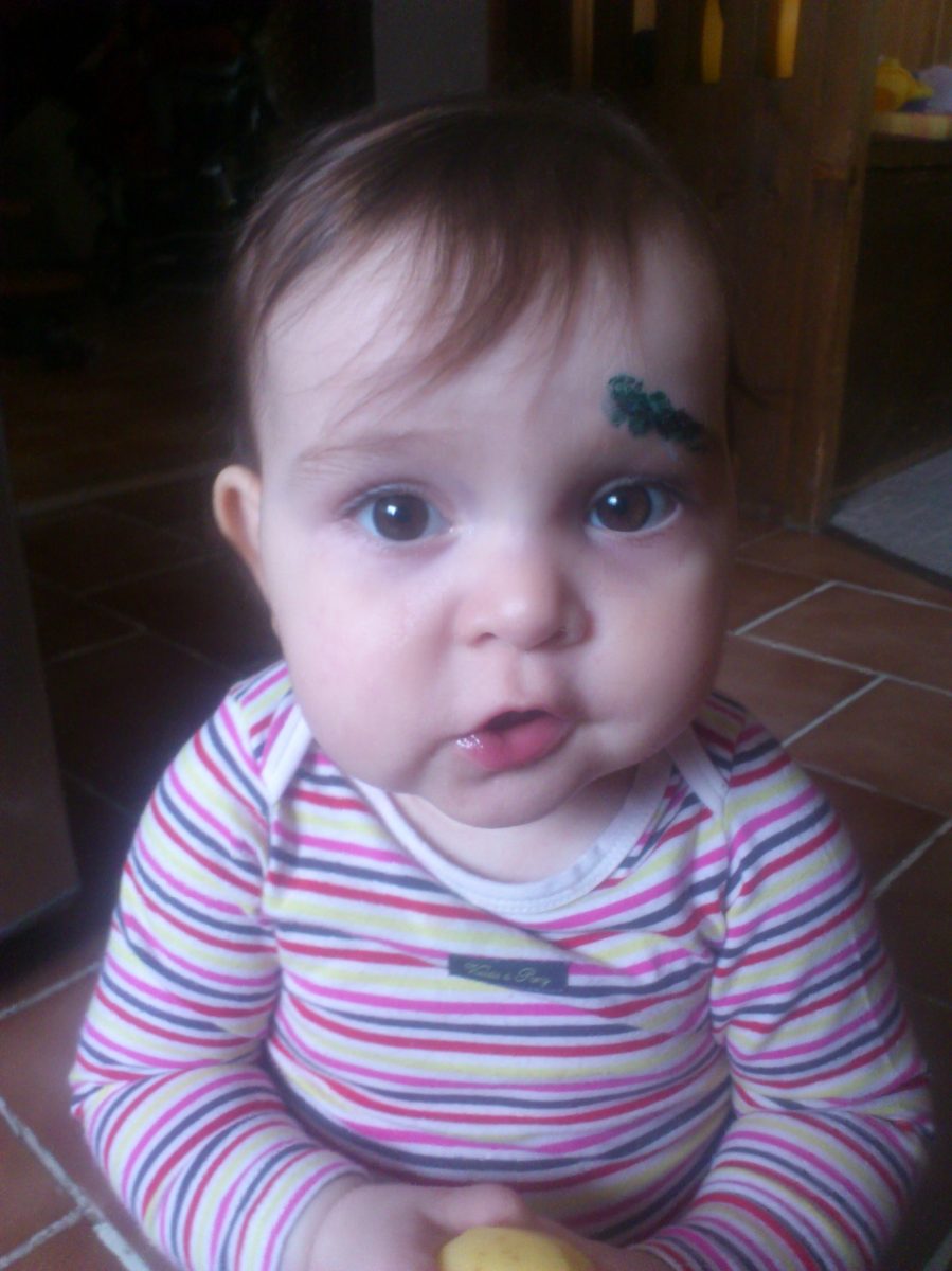 Fotografie ( První velký úraz)