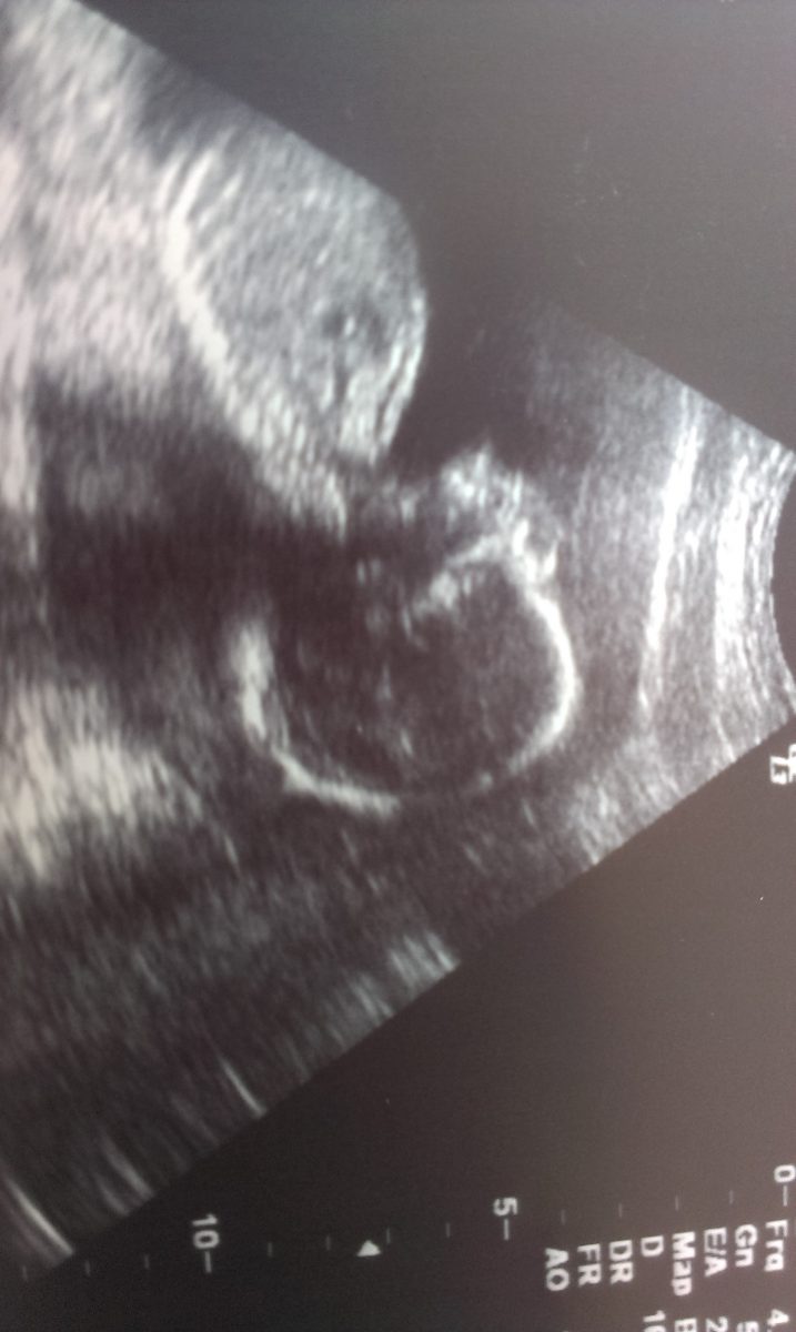 Fotografie (Pokrok nezastavíš :))