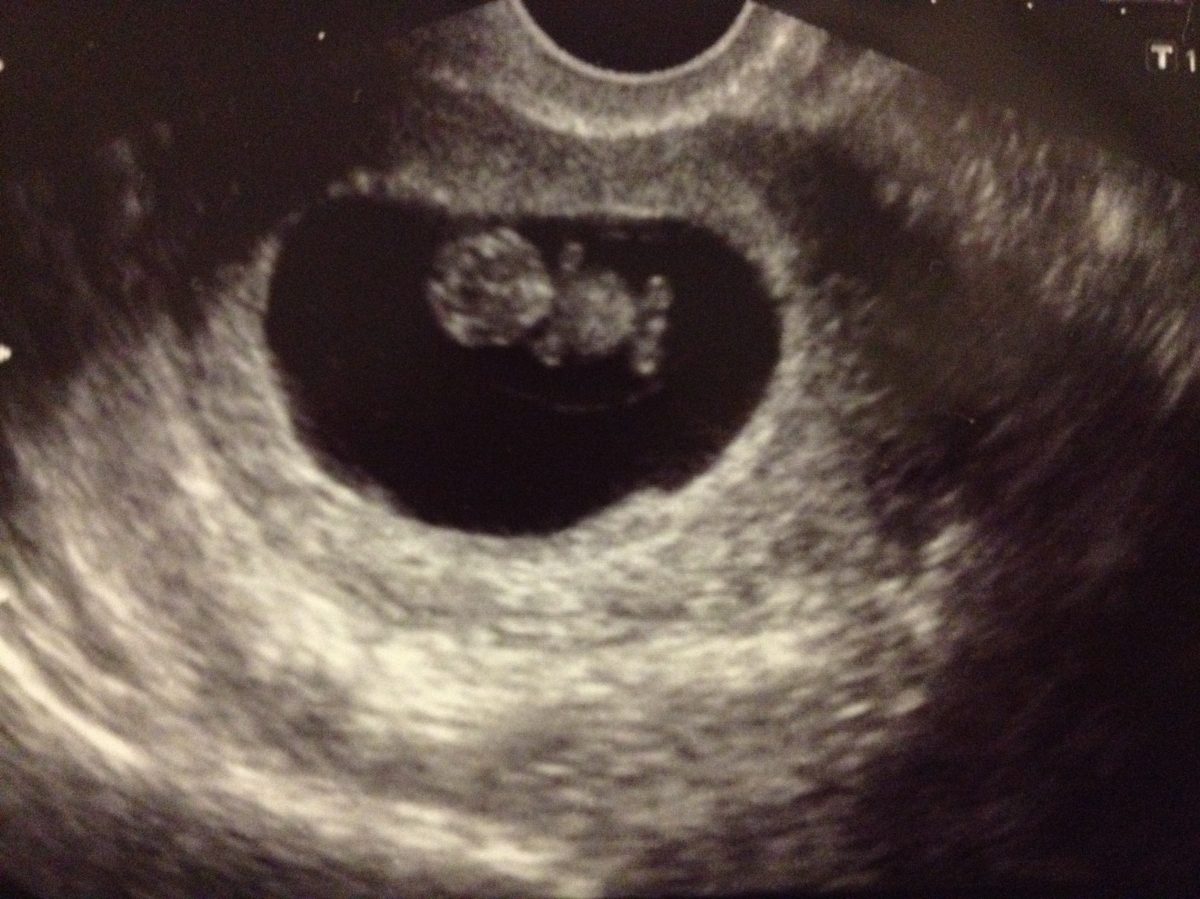 Fotografie (Přecitlivělost)