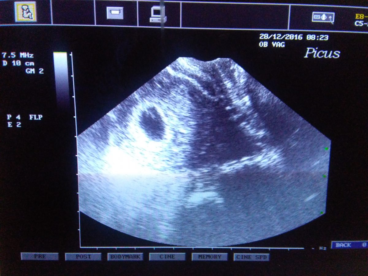 Fotografie (Afetální plodové vejce)