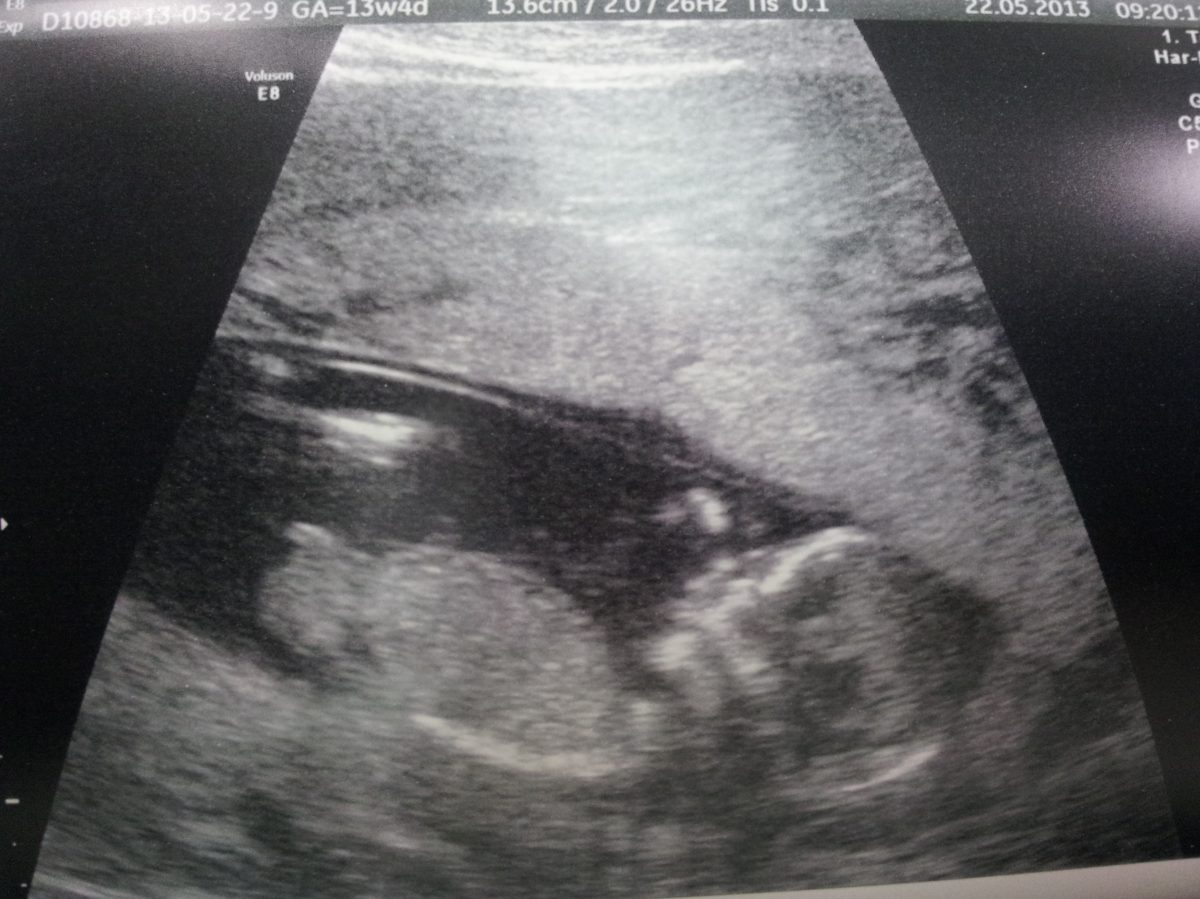 Fotografie (Slůně)