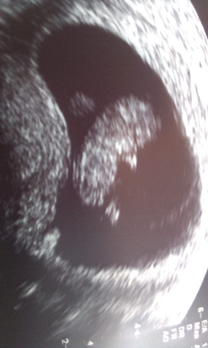 Fotografie (Mrňousek :))