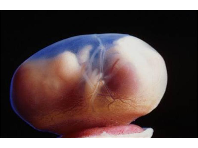 Co jíst po transferu embrya?